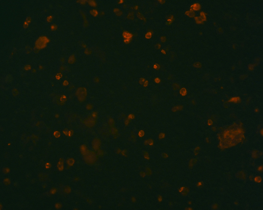The plasmid was transfected into 293H adherent cells with Sinofection reagent (Cat# STF01). After 48 h, Immunofluorescence staining of cells. Cells were fixed with 4% PFA, permeabilzed with 0.3% Triton X-100 in PBS, blocked with 10% serum, and incubated with Mouse anti-Flag Tag monoclonal antibody (CST#8146S) at 37℃ 1 hour. Then cells were stained with Goat Anti-mouse IgG secondary antibody. The fluorescent signal is detected by fluorescence microscope. Each expression experiment has negative control.