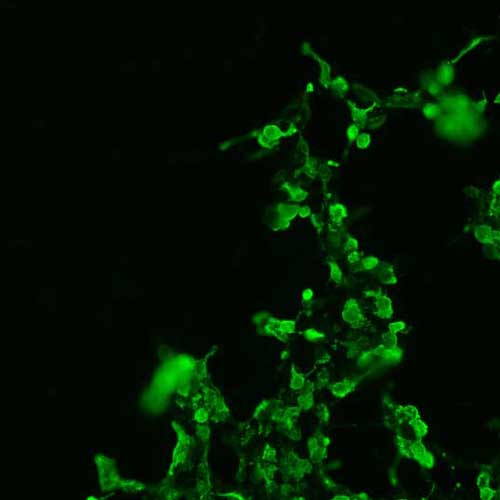 The plasmid was transfected into 293H adherent cells with Sinofection reagent (Cat# STF01). After 48 h, Immunofluorescence staining of cells. Cells were fixed with 4% PFA, permeabilzed with 0.3% Triton X-100 in PBS, blocked with 10% serum, and incubated with Mouse anti-Flag Tag monoclonal antibody (CST#8146S) at 37℃ 1 hour. Then cells were stained with Goat Anti-mouse IgG secondary antibody. The fluorescent signal is detected by fluorescence microscope. Each expression experiment has negative control.