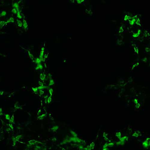 The plasmid was transfected into 293H adherent cells with Sinofection reagent (Cat# STF01). After 48 h, Immunofluorescence staining of cells. Cells were fixed with 4% PFA, permeabilzed with 0.3% Triton X-100 in PBS, blocked with 10% serum, and incubated with Mouse anti-Flag Tag monoclonal antibody (CST#8146S) at 37℃ 1 hour. Then cells were stained with Goat Anti-mouse IgG secondary antibody. The fluorescent signal is detected by fluorescence microscope. Each expression experiment has negative control.