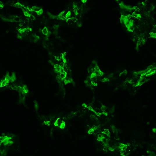 The plasmid was transfected into 293H adherent cells with Sinofection reagent (Cat# STF01). After 48 h, Immunofluorescence staining of cells. Cells were fixed with 4% PFA, permeabilzed with 0.3% Triton X-100 in PBS, blocked with 10% serum, and incubated with Mouse anti-Flag Tag monoclonal antibody (CST#8146S) at 37℃ 1 hour. Then cells were stained with Goat Anti-mouse IgG secondary antibody. The fluorescent signal is detected by fluorescence microscope. Each expression experiment has negative control.
