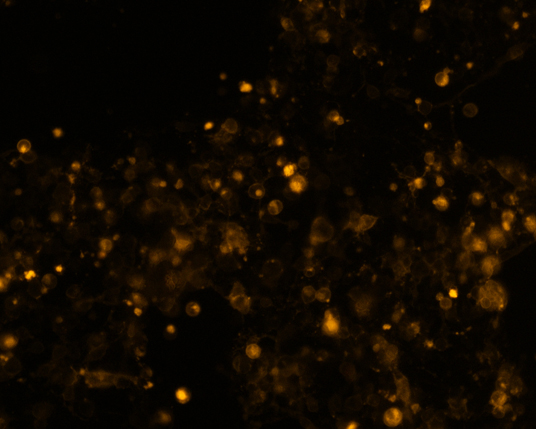 The plasmid was transfected into 293H adherent cells with Sinofection reagent (Cat#STF01) transiently. After 48 h, the fluorescent signals can be detected by fluorescence microscope. Green excitation 475/40nm, emission 535/45nm. Red excitation 560/55nm, emission 645/45nm. Orange excitation 525/45nm, emission 595/60nm.