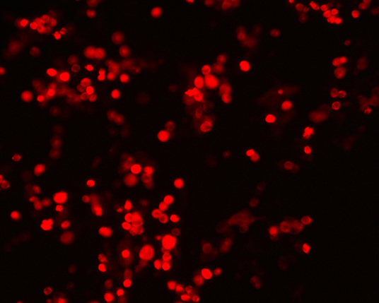 The plasmid was transfected into 293H adherent cells with Sinofection reagent (Cat#STF01) transiently. After 48 h, the fluorescent signals can be detected by fluorescence microscope. Green excitation 475/40nm, emission 535/45nm. Red excitation 560/55nm, emission 645/45nm. Orange excitation 525/45nm, emission 595/60nm.