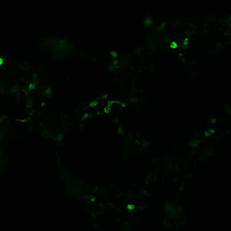 The plasmid was transfected into 293H adherent cells with Sinofection reagent (Cat# STF01). After 48 h, Immunofluorescence staining of cells. Cells were fixed with 4% PFA, permeabilzed with 0.3% Triton X-100 in PBS, blocked with 10% serum, and incubated with Mouse anti-Flag Tag monoclonal antibody (CST#8146S) at 37℃ 1 hour. Then cells were stained with Goat Anti-mouse IgG secondary antibody. The fluorescent signal is detected by fluorescence microscope. Each expression experiment has negative control.
