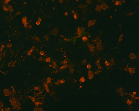 The plasmid was transfected into 293H adherent cells with Sinofection reagent (Cat# STF01). After 48 h, Immunofluorescence staining of cells. Cells were fixed with 4% PFA, permeabilzed with 0.3% Triton X-100 in PBS, blocked with 10% serum, and incubated with Mouse anti-Flag Tag monoclonal antibody (CST#8146S) at 37℃ 1 hour. Then cells were stained with Goat Anti-mouse IgG secondary antibody. The fluorescent signal is detected by fluorescence microscope. Each expression experiment has negative control.
