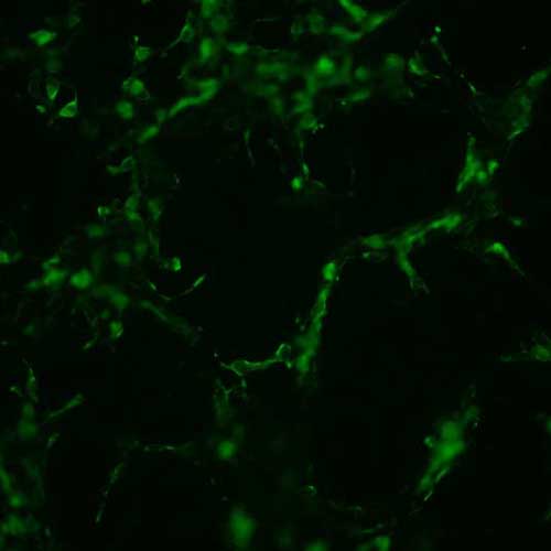 The plasmid was transfected into 293H adherent cells with Sinofection reagent (Cat# STF01). After 48 h, Immunofluorescence staining of cells. Cells were fixed with 4% PFA, permeabilzed with 0.3% Triton X-100 in PBS, blocked with 10% serum, and incubated with Mouse anti-Flag Tag monoclonal antibody (CST#8146S) at 37℃ 1 hour. Then cells were stained with Goat Anti-mouse IgG secondary antibody. The fluorescent signal is detected by fluorescence microscope. Each expression experiment has negative control.