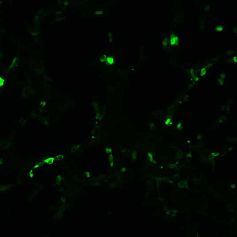 The plasmid was transfected into 293H adherent cells with Sinofection reagent (Cat# STF01). After 48 h, Immunofluorescence staining of cells. Cells were fixed with 4% PFA, permeabilzed with 0.3% Triton X-100 in PBS, blocked with 10% serum, and incubated with Mouse anti-Flag Tag monoclonal antibody (CST#8146S) at 37℃ 1 hour. Then cells were stained with Goat Anti-mouse IgG secondary antibody. The fluorescent signal is detected by fluorescence microscope. Each expression experiment has negative control.