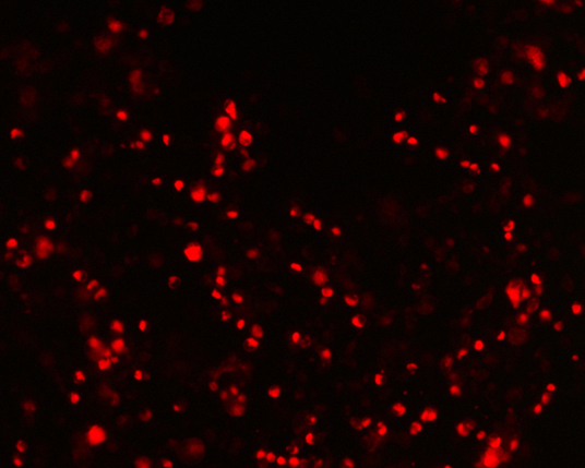 The plasmid was transfected into 293H adherent cells with Sinofection reagent (Cat#STF01) transiently. After 48 h, the fluorescent signals can be detected by fluorescence microscope. Green excitation 475/40nm, emission 535/45nm. Red excitation 560/55nm, emission 645/45nm. Orange excitation 525/45nm, emission 595/60nm.