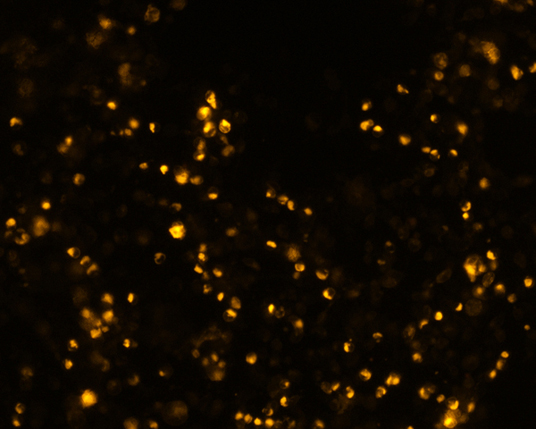The plasmid was transfected into 293H adherent cells with Sinofection reagent (Cat#STF01) transiently. After 48 h, the fluorescent signals can be detected by fluorescence microscope. Green excitation 475/40nm, emission 535/45nm. Red excitation 560/55nm, emission 645/45nm. Orange excitation 525/45nm, emission 595/60nm.