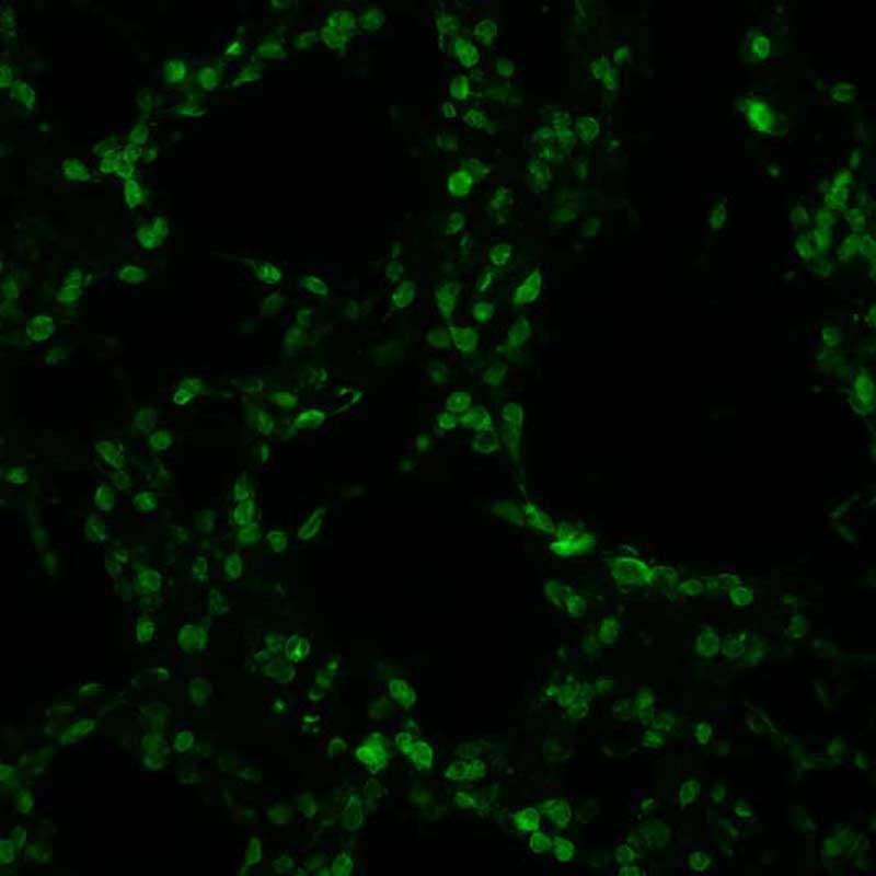 The plasmid was transfected into 293H adherent cells with Sinofection reagent (Cat# STF01). After 48 h, Immunofluorescence staining of cells. Cells were fixed with 4% PFA, permeabilzed with 0.3% Triton X-100 in PBS, blocked with 10% serum, and incubated with Mouse anti-Flag Tag monoclonal antibody (CST#8146S) at 37℃ 1 hour. Then cells were stained with Goat Anti-mouse IgG secondary antibody. The fluorescent signal is detected by fluorescence microscope. Each expression experiment has negative control.