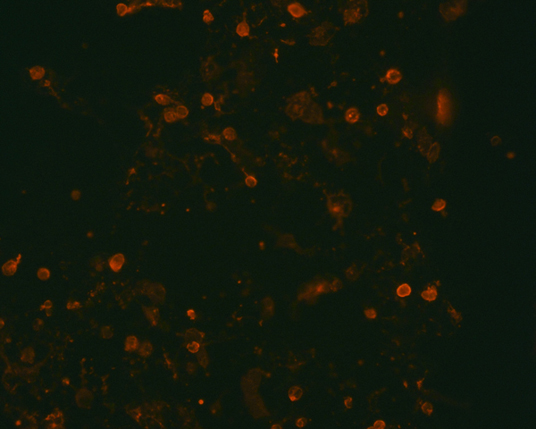 The plasmid was transfected into 293H adherent cells with Sinofection reagent (Cat# STF01). After 48 h, Immunofluorescence staining of cells. Cells were fixed with 4% PFA, permeabilzed with 0.3% Triton X-100 in PBS, blocked with 10% serum, and incubated with Mouse anti-Flag Tag monoclonal antibody (CST#8146S) at 37℃ 1 hour. Then cells were stained with Goat Anti-mouse IgG secondary antibody. The fluorescent signal is detected by fluorescence microscope. Each expression experiment has negative control.