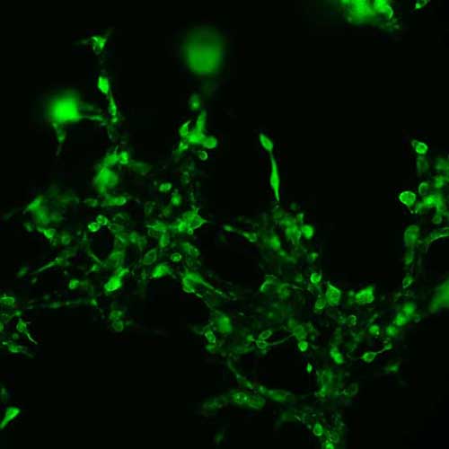 The plasmid was transfected into 293H adherent cells with Sinofection reagent (Cat# STF01). After 48 h, Immunofluorescence staining of cells. Cells were fixed with 4% PFA, permeabilzed with 0.3% Triton X-100 in PBS, blocked with 10% serum, and incubated with Mouse anti-Flag Tag monoclonal antibody (CST#8146S) at 37℃ 1 hour. Then cells were stained with Goat Anti-mouse IgG secondary antibody. The fluorescent signal is detected by fluorescence microscope. Each expression experiment has negative control.