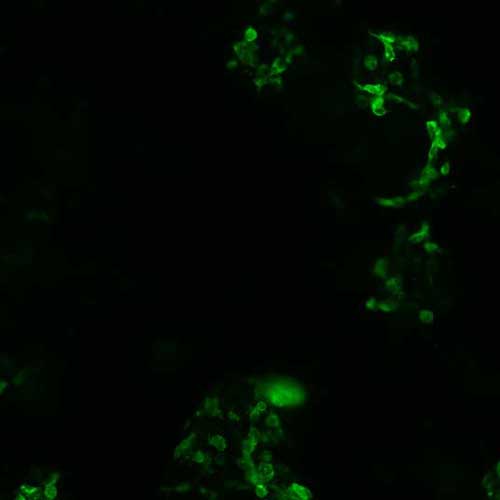 The plasmid was transfected into 293H adherent cells with Sinofection reagent (Cat# STF01). After 48 h, Immunofluorescence staining of cells. Cells were fixed with 4% PFA, permeabilzed with 0.3% Triton X-100 in PBS, blocked with 10% serum, and incubated with Mouse anti-Flag Tag monoclonal antibody (CST#8146S) at 37℃ 1 hour. Then cells were stained with Goat Anti-mouse IgG secondary antibody. The fluorescent signal is detected by fluorescence microscope. Each expression experiment has negative control.