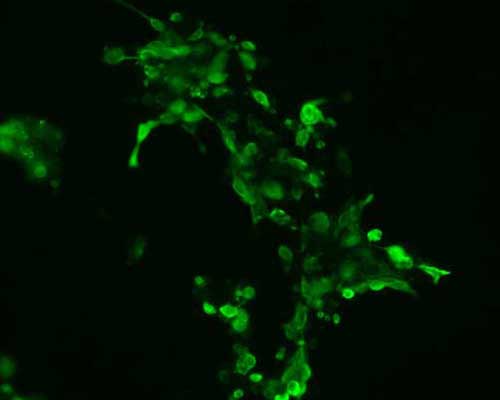The plasmid was transfected into 293H adherent cells with Sinofection reagent (Cat# STF01). After 48 h, Immunofluorescence staining of cells. Cells were fixed with 4% PFA, permeabilzed with 0.3% Triton X-100 in PBS, blocked with 10% serum, and incubated with Mouse anti-Flag Tag monoclonal antibody (CST#8146S) at 37℃ 1 hour. Then cells were stained with Goat Anti-mouse IgG secondary antibody. The fluorescent signal is detected by fluorescence microscope. Each expression experiment has negative control.