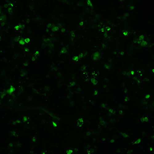 The plasmid was transfected into 293H adherent cells with Sinofection reagent (Cat# STF01). After 48 h, Immunofluorescence staining of cells. Cells were fixed with 4% PFA, permeabilzed with 0.3% Triton X-100 in PBS, blocked with 10% serum, and incubated with Mouse anti-Flag Tag monoclonal antibody (CST#8146S) at 37℃ 1 hour. Then cells were stained with Goat Anti-mouse IgG secondary antibody. The fluorescent signal is detected by fluorescence microscope. Each expression experiment has negative control.