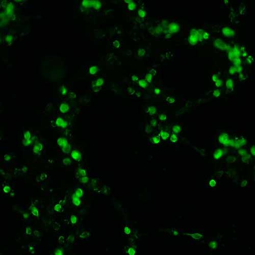 The plasmid was transfected into 293H adherent cells with Sinofection reagent (Cat# STF01). After 48 h, Immunofluorescence staining of cells. Cells were fixed with 4% PFA, permeabilzed with 0.3% Triton X-100 in PBS, blocked with 10% serum, and incubated with Mouse anti-Flag Tag monoclonal antibody (CST#8146S) at 37℃ 1 hour. Then cells were stained with Goat Anti-mouse IgG secondary antibody. The fluorescent signal is detected by fluorescence microscope. Each expression experiment has negative control.