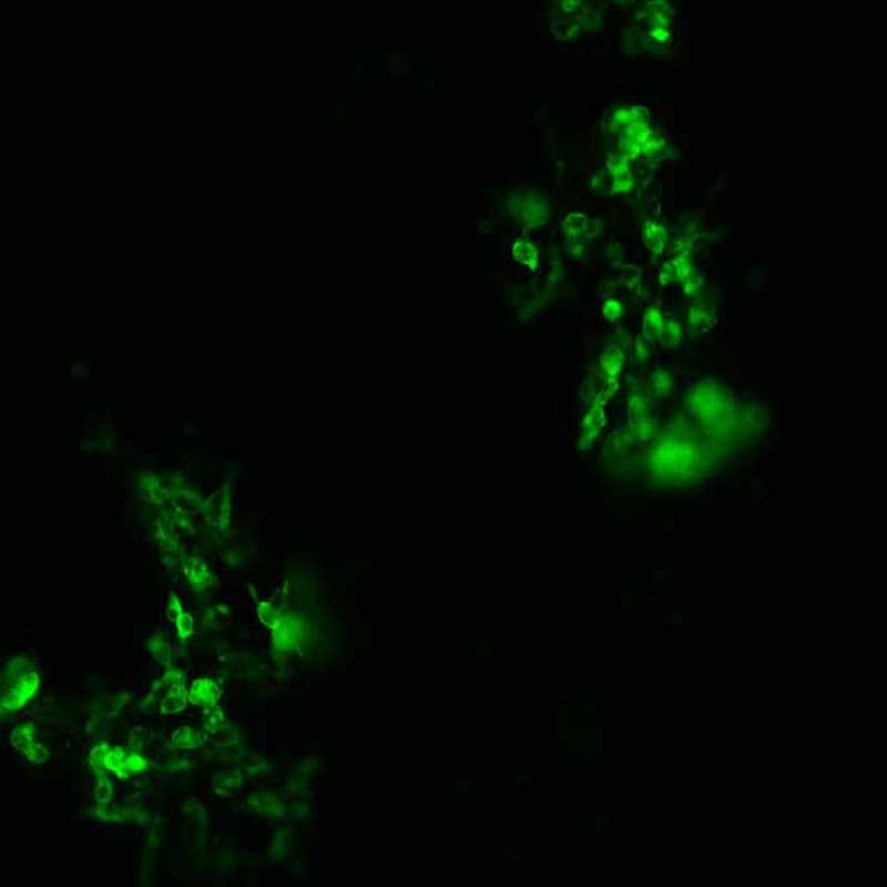 The plasmid was transfected into 293H adherent cells with Sinofection reagent (Cat# STF01). After 48 h, Immunofluorescence staining of cells. Cells were fixed with 4% PFA, permeabilzed with 0.3% Triton X-100 in PBS, blocked with 10% serum, and incubated with Mouse anti-Flag Tag monoclonal antibody (CST#8146S) at 37℃ 1 hour. Then cells were stained with Goat Anti-mouse IgG secondary antibody. The fluorescent signal is detected by fluorescence microscope. Each expression experiment has negative control.