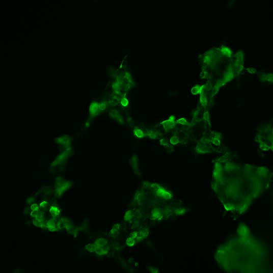 The plasmid was transfected into 293H adherent cells with Sinofection reagent (Cat# STF01). After 48 h, Immunofluorescence staining of cells. Cells were fixed with 4% PFA, permeabilzed with 0.3% Triton X-100 in PBS, blocked with 10% serum, and incubated with Mouse anti-Flag Tag monoclonal antibody (CST#8146S) at 37℃ 1 hour. Then cells were stained with Goat Anti-mouse IgG secondary antibody. The fluorescent signal is detected by fluorescence microscope. Each expression experiment has negative control.