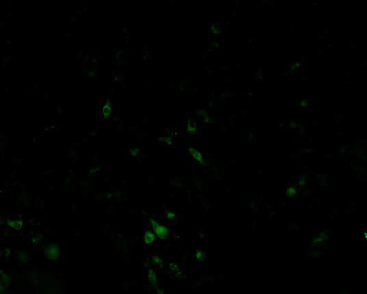 The plasmid was transfected into 293H adherent cells with Sinofection reagent (Cat# STF01). After 48 h, Immunofluorescence staining of cells. Cells were fixed with 4% PFA, permeabilzed with 0.3% Triton X-100 in PBS, blocked with 10% serum, and incubated with Mouse anti-Flag Tag monoclonal antibody (CST#8146S) at 37℃ 1 hour. Then cells were stained with Goat Anti-mouse IgG secondary antibody. The fluorescent signal is detected by fluorescence microscope. Each expression experiment has negative control.