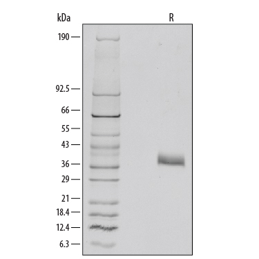 1 µg/lane of Recombinant Mouse Dkk-1 was resolved with SDS-PAGE under reducing (R) conditions and visualized by silver staining, showing major bands at 35-40 kDa. Multiple bands in gel are due to variable glycosylation.