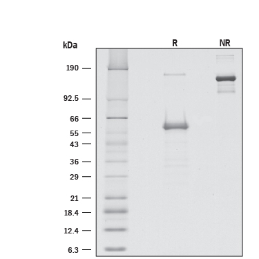 1 μg/lane of RecombinantHuman CD277/BTN3A1 (Catalog # 8539-BT) was resolved with SDS-PAGE underreducing (R) and non-reducing (NR) conditions and visualized by silverstaining, showing bands at 58.8 and 150 kDa, respectively.