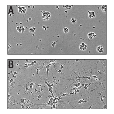 Recombinant Human Slit3 (Catalog # 9067-SL) Induces Cortical Neurite Outgrowth. A) Untreated E16-E18 embryonic rat cortical neurons. B) Neurite outgrowth in E16-E18 embryonic rat cortical neurons treated with 1.25 µg/ml of Recombinant Human Slit3.