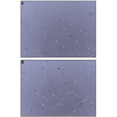 Recombinant Human Neuroligin 4Y/NLGN4Y (Catalog # 9119-NL) Enhances Neurite Outgrowth in E13 Chick Embryonic Dorsal Root Ganglia (DRG) Neurons. A) Untreated E13 DRG neurons show minimal neurite outgrowth. B) Recombinant Human Neuroligin 4Y/NLGN4Y, immobilized at 10 µg/mL, enhances DRG neuron neurite outgrowth.