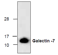 Anti-Galectin-7 recombinant protein used in Western blot. GTX65162