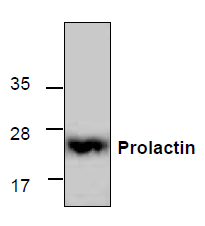 Anti-Prolactin recombinant protein used in Western blot. GTX65405