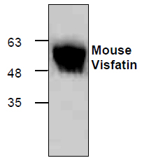 Anti-Visfatin recombinant protein used in Western blot. GTX65439