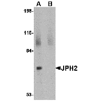 Anti-JPH2 Peptide used in Western blot. GTX85367-PEP