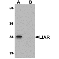 Anti-LIAR Peptide used in Western blot. GTX85269-PEP