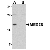 Anti-MED28 Peptide used in Western blot. GTX85388-PEP