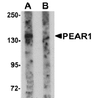 Anti-PEAR1 Peptide used in Western blot. GTX85138-PEP