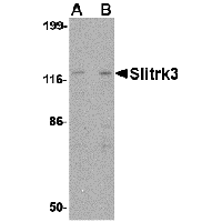 Anti-Slitrk3 Peptide used in Western blot. GTX85417-PEP