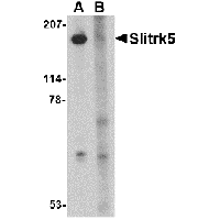 Anti-Slitrk5 Peptide used in Western blot. GTX85413-PEP