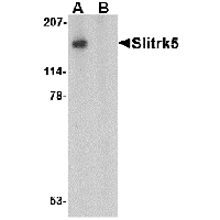 Anti-Slitrk5 Peptide used in Western blot. GTX85414-PEP
