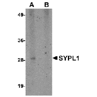 Anti-SYPL1 Peptide used in Western blot. GTX85262-PEP