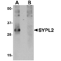 Anti-SYPL2 Peptide used in Western blot. GTX85272-PEP