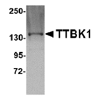 Anti-ZBED3 Peptide used in Western blot. GTX85295-PEP