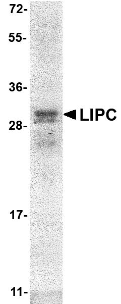 Anti-LIPC Recombinant Protein used in Western blot. GTX49352