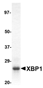 Anti-XBP1 Recombinant Protein used in Western blot. GTX48114-PRO