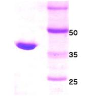 15% SDS-PAGE gel loaded with recombinant human HtrA2/Omi protein.