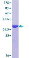 ab164959 on a 12.5% SDS-PAGE stained with Coomassie Blue.