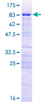 ab161616 on a 12.5% SDS-PAGE stained with Coomassie Blue.