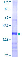 ab152907 on a 12.5% SDS-PAGE stained with Coomassie Blue.
