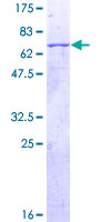 ab160007 on a 12.5% SDS-PAGE stained with Coomassie Blue.