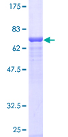 ab160008 on a 12.5% SDS-PAGE stained with Coomassie Blue.