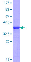 ab161685 on a 12.5% SDS-PAGE stained with Coomassie Blue.