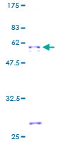 ab157930 on a 12.5% SDS-PAGE stained with Coomassie Blue.
