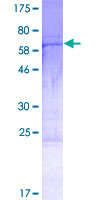 ab165926 on a 12.5% SDS-PAGE stained with Coomassie Blue.